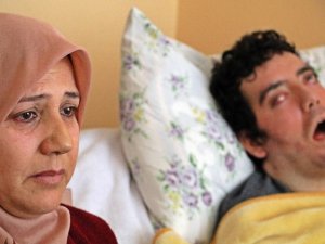 6 Yıldır Gözlerini Kırpamıyor, Kan Çanağına Dönen Gözleri Bantla Kapatılıyor