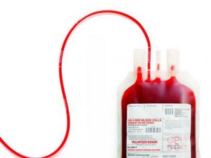 Acil Plazma Kan Aranıyor