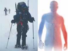 Çığda Ölüm Nedeni Hipotermi