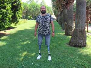 Depremde 2 Bacağını Kaybetti, Azmi İle Herkese Umut Oluyor