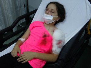 Samsun’da Pitbull Dehşeti: 11 Yaşındaki Kız Çocuğu Kanlar İçerisinde Kaldı