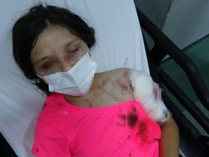 Kız Çocuğuna Dehşeti Yaşatan Pitbullun Sahibine Ceza Yağacak