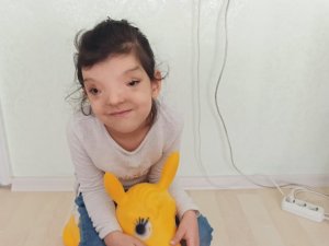 Bu Hastalık Dünyada Sadece 4 Kişide Var