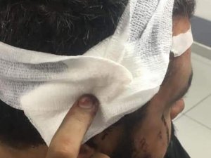 Lübnan’da Şiddetlenen Protestolarda 220 Yaralı