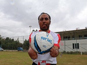 Yangında Ellerini Ve Yüzünü Kaybetti, Futbolda Gol Makinesi Oldu