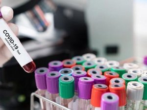 Japonya’da Covid-19’a Bağlı Günlük Ölüm Sayısı Rekor Kırdı