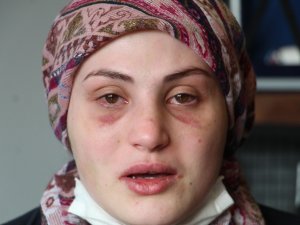 Kaçarak Evlendiği Eşi, Genç Kadına Kabusu Yaşattı