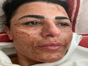 Sosyal Medyada Gördüğü Cilt Toparlama İlanıyla Hayatı Kabusa Döndü