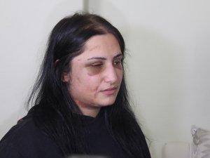 Samsun’daki Kadına Şiddet Olayının İddianamesi Kabul Edildi