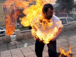 O ’Dehşet Fotoğraf’taki Kişi Konuştu: "Ateşe Yaklaşamıyorum"