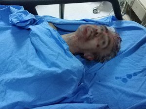 Samsun’daki Silahlı Saldırıda Ölü Sayısı 2’ye Çıktı