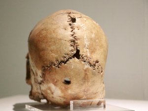 Dünyadaki İlk Beyin Ameliyatının Yapıldığı Aşıklı Höyük 11 Bin Yıllık Tarihe Işık Tutuyor