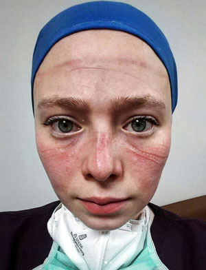 Hemşire çiftin salgın nedeniyle ertelenen düğünü bir yıl sonra yapıldı