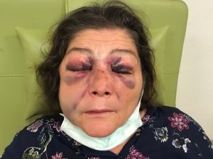 Ak Kadınlar, Eynesil’deki Kadına Yönelik Şiddeti Kınadı