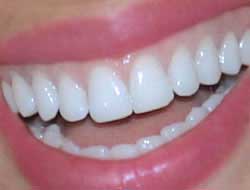 Beyaz dişler için 10 TAVSİYE