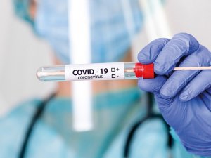 Almanya’da 11 Ekim’den İtibaren Covid-19 Testleri Ücretli Olacak