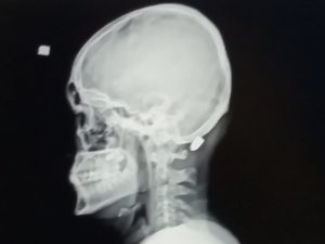 Trabzon’da Yorgun Mermilerin Failleri Bulunamıyor