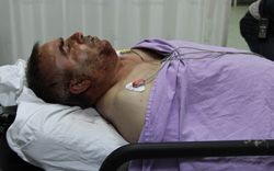Samsun'da damat dehşeti 4 yaralı