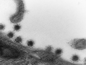 Rusya’da Korona Virüsün Delta Plus Mutasyonu Görüntülendi