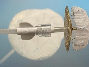 Hayat Kurtaran Lambre Yöntemi’ne Birincilik Ödülü