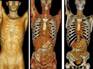 Tıbbın Gören Gözleri Ve Görünmeyen Emekçilerinin Günü