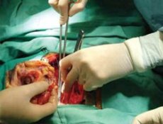 50 Bin Diyaliz Hastası Böbrek Umuduyla Yaşıyor