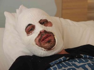 Kafe Yangınında Canını Zor Kurtardı