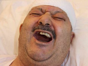 Diş Ağrısı Sanıp 6 Sağlam Dişini Çektirdi, Meğer Gerçek Bambaşka Çıktı