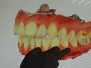 Korona Virüs Diş Ağrılarını Arttırdı