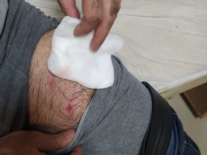 Bingöl’de Köpek Sürüsü, Evine Giden Adama Saldırdı