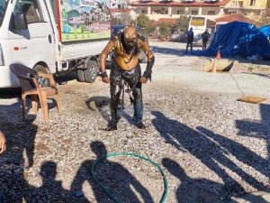 Her Yeri Yandı, Hiçbir Şey Olmamış Gibi Derdini Anlatmaya Çalıştı