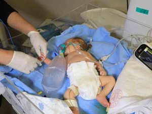 Ambulans Helikopterle Adana’ya Getirilen Minik Ahmet’in Durumu İyi