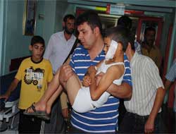 Erzincan'da kurt dehşeti 12 yaralı