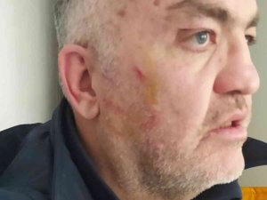 Ambulans Şoförü Darp Edildi
