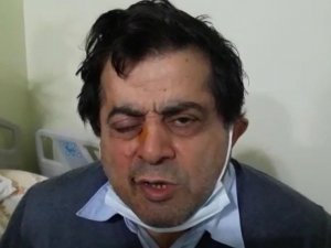Kafasına Çatıdan Buz Kütlesi Düştü, Ölümden Döndü