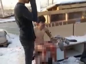 Kaportacıda Çıkan Yangında Bir Genç Ağır Yaralandı