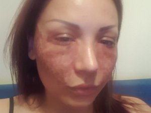 Bulgar Modelin Estetik Davasında Kuaför Kardeşler ‘İftira’ Dedi