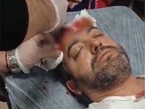 Avukata Beyzbol Sopalı Saldırıda Bulunan Sanık İçin İstenen Ceza Belli Oldu