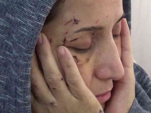 Yeğeni Elini Öpmedi Diye Dövdü, Sonra Da Yengesini 50 Yerinden Bıçakladı