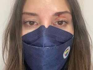 Eski Futbolcu Özer Hurmacı’nın Eşini Darp Ettiği İddiası