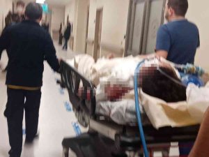 Üsküdar’da Meydana Gelen Doğal Gaz Patlamasında Yaralanan Vatandaşın Tedavisi Yanık Ünitesinde Sürüyor