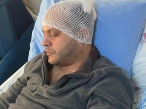 Doktoru Öldüresiye Darp Eden Hasta Yakını Tutuklandı