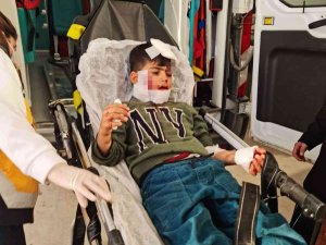 Nusaybin’de Köpeklerin Saldırısına Uğrayan Çocuk Ağır Yaralandı