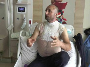 Banyo Yaparken Kazayla Kendini Yaktı