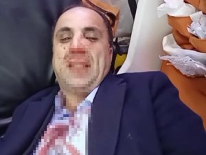 Diyarbakır Berberler, Kuaförler Ve Güzellik Uzmanları Esnaf Odası Başkanlık Seçiminde Kavga