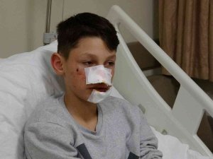 Köpek Saldırısına Uğrayan Çocuk Yüz Bölgesinden Yaralandı