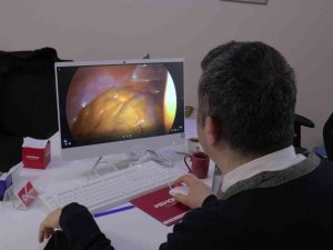 Hastalar İçin Kolay Tedavi: “Laparoskopik Cerrahi”