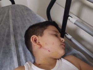 Başkent’te İlkokul Öğrencisine Sokak Köpekleri Saldırdı
