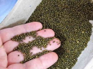 Safra Kesesinden Çıkanlar Şaşırttı, Guinness’e Başvuru Yapacaklar