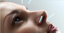 Akupunktur ağrı kesmiyor